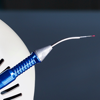 Biolase® Laser Dentistry Image
