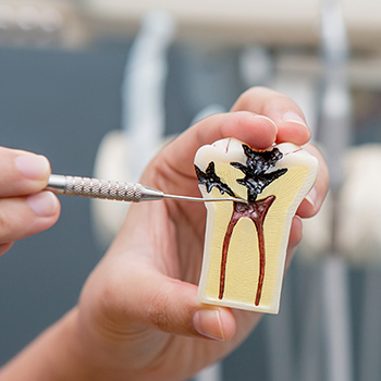 endodontics image